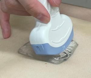 Newly developed tamarind seed gum solid gel pad improves patient satisfaction during ultrasound examinations