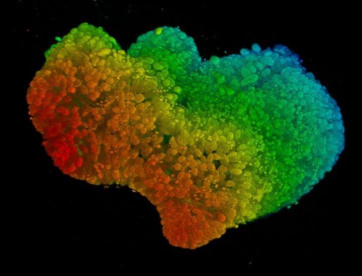 Organoid