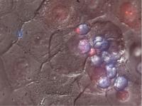 Chytrid Fungus