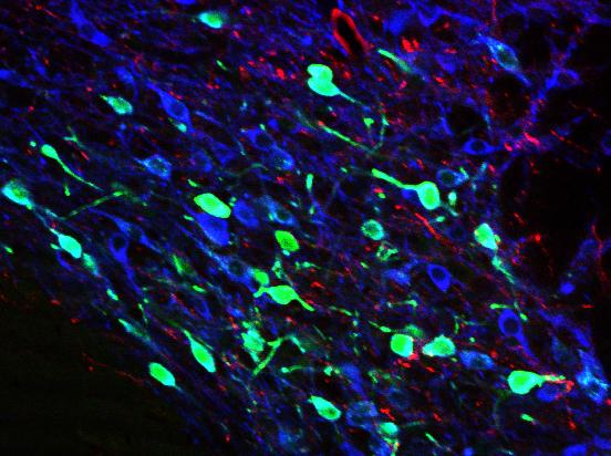 Labelled Neurons in Reward Circuitry