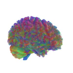 Era Three: A representative MRI tractography image of the third era of the human brain.