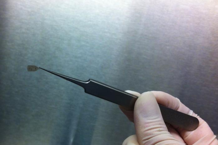 Researchers at Keck Medicine of USC are launching a phase 2b clinical trial examining if stem cells bioengineered to replace failing cells in the retina damaged by macular degeneration could restore eyesight.