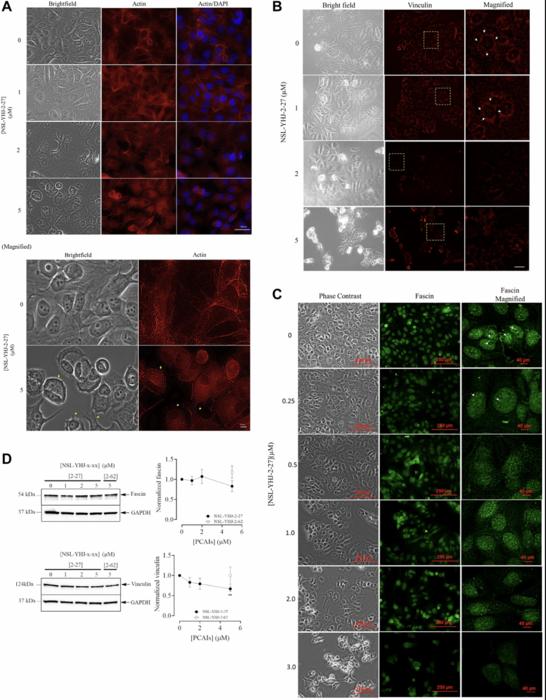 PCAIs stimulate MAPK, PI3K/AKT pathways and ROS-Mediated apoptosis in aromatase inhibitor-resistant breast cancer cells while disrupting actin filaments and focal adhesion