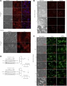 PCAIs stimulate MAPK, PI3K/AKT pathways and ROS-Mediated apoptosis in aromatase inhibitor-resistant breast cancer cells while disrupting actin filaments and focal adhesion