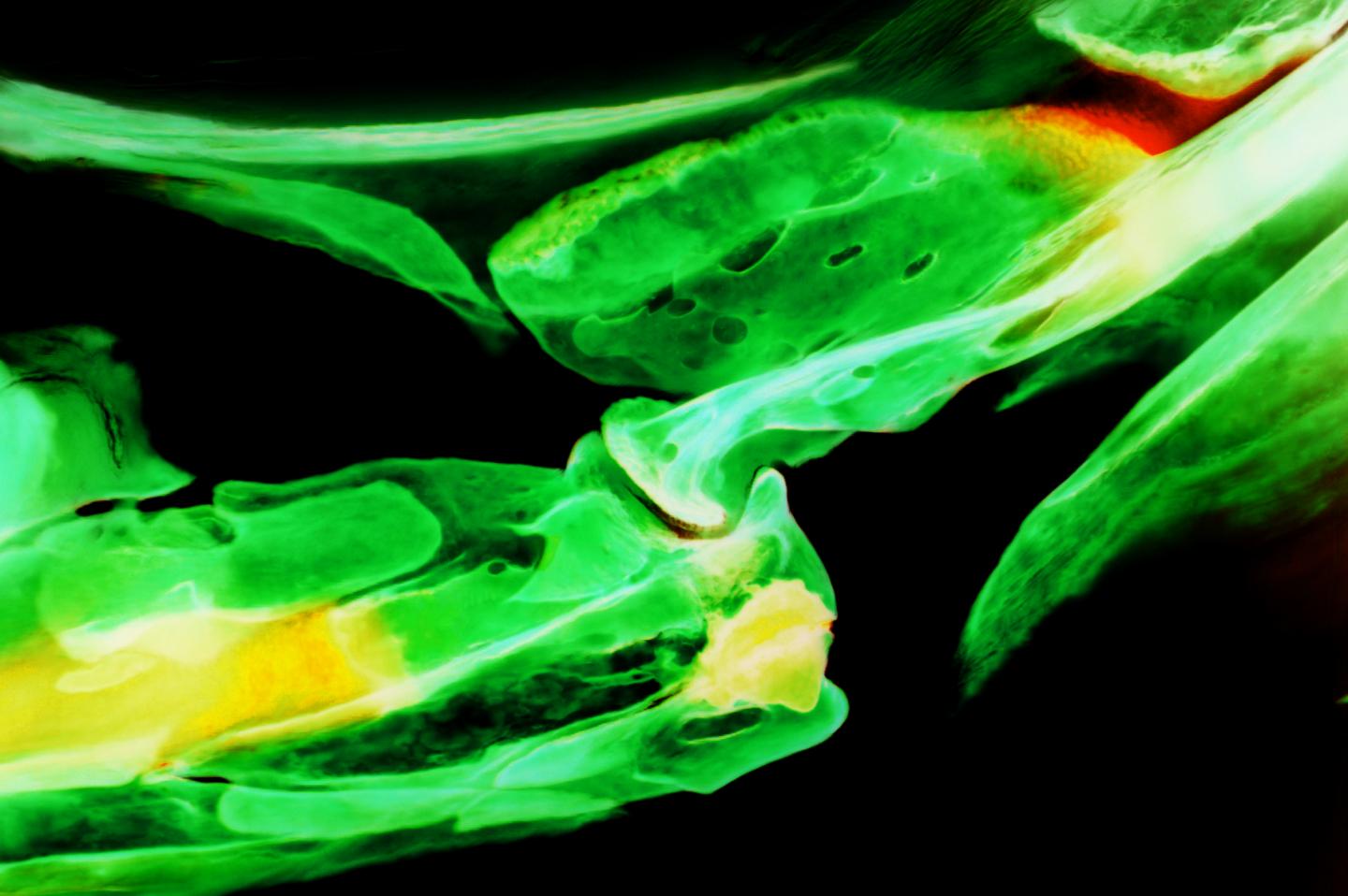 Zebrafish Jaw