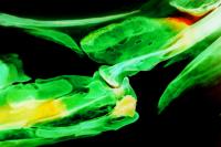 Zebrafish Jaw