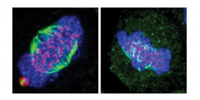 Human Cancer Cells Going Through the Process of Division