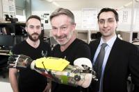 Building a Better Bionic Hand