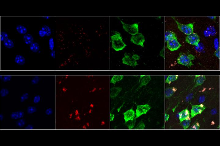 Biologists Discover an Unusual Hallmark of Aging in Neurons