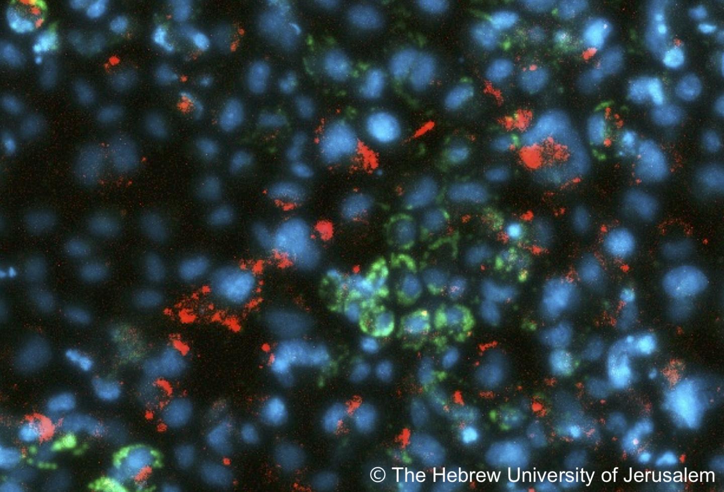 Hepatitis C Virus Imaging