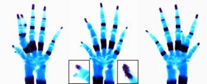 Skeletal limb abnormalities associated with engrailed-1 mouse mutants