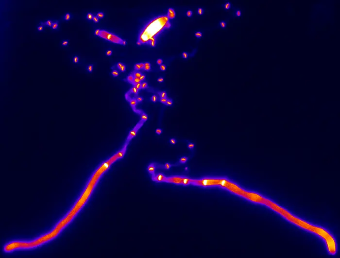 Fluorescence microscopy image of Ustilago maydis hyphae