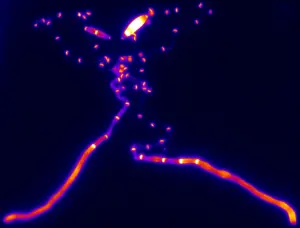 Fluorescence microscopy image of Ustilago maydis hyphae
