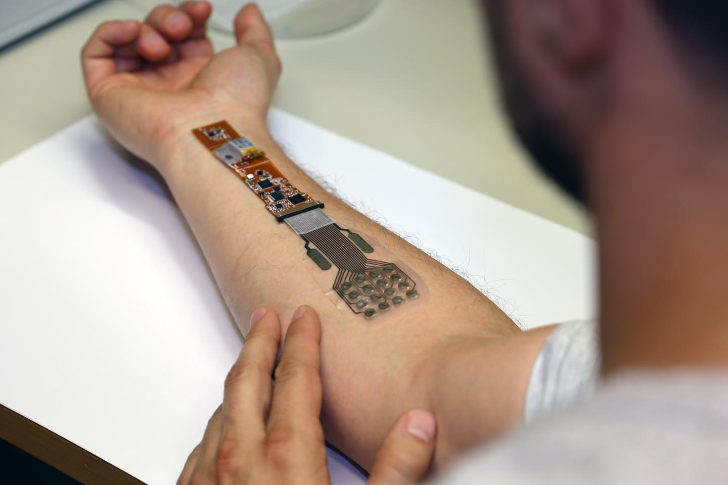 Photo 1 VTT's Wound Care Prototype