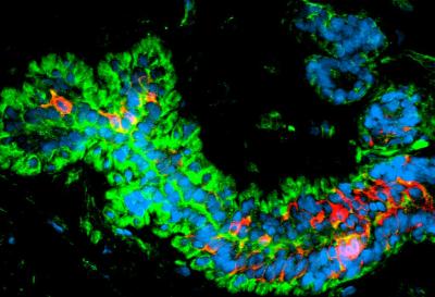 Mammary Stem Cells
