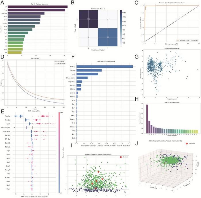 Machine learning identifies SPP1-related modules as top predictive features