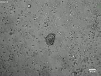 Tumor Cells Reprogram NK Cells