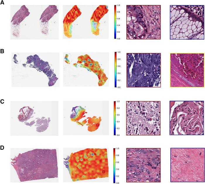 The fine-tuned model predicted seven outputs using whole slide images (WSIs)