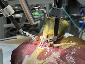 The Surgical Robot Transformer-Hierarchy performing a gallbladder surgery
