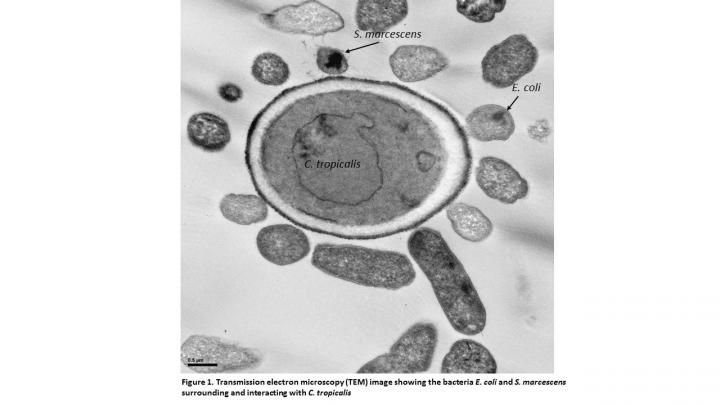 Antifungals and Probiotics May Play a Key Role in the Development of Treatment for Crohn's Disease