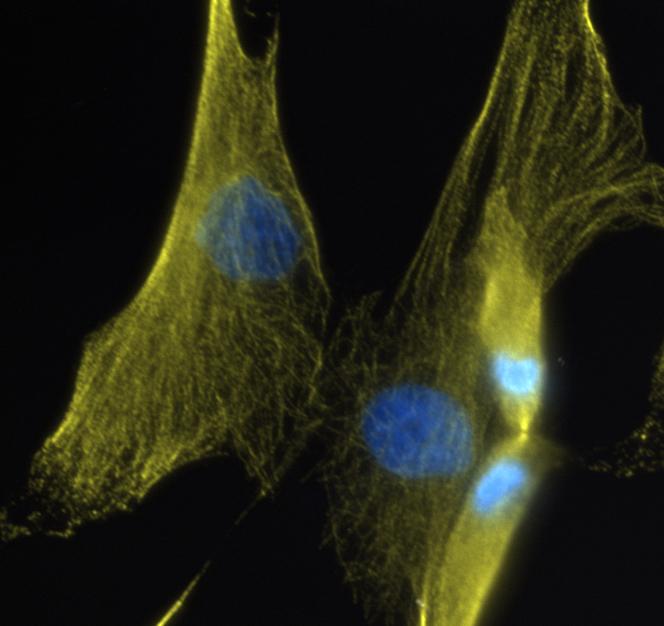 Human Fibroblasts Undergoing Cell Division