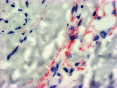 Neuronal Infection