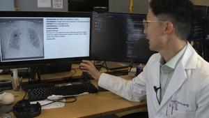 Dr. Huang explains how the AI software works