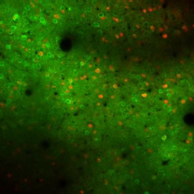Mouse Motor Cortex