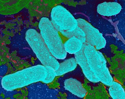 <i>Haemophilus influenzae</i> Bacteria Attaching to a Surface