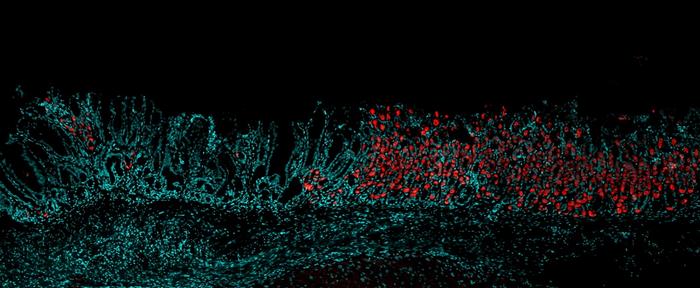 Comparing normal stomach cells to Arid1a-deficient cells
