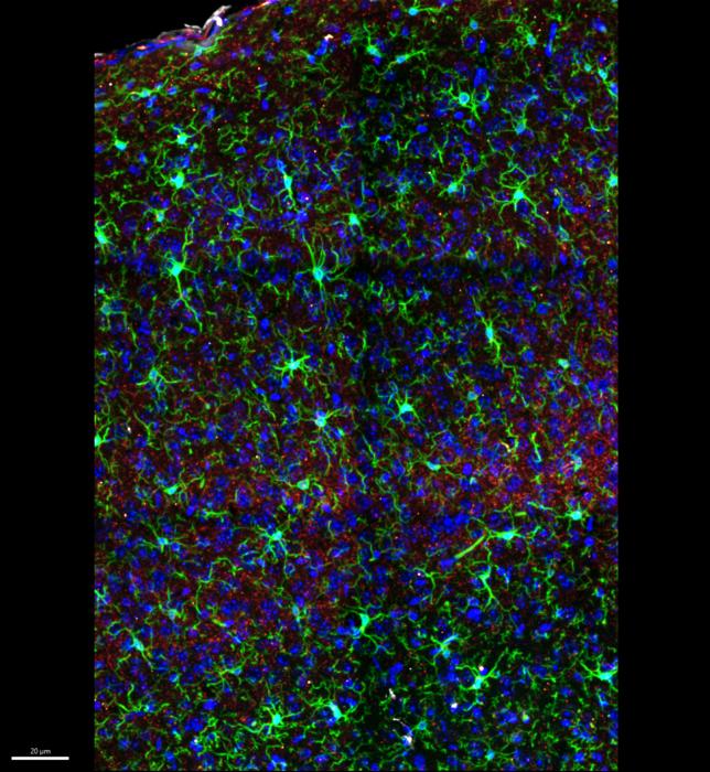 Microglia