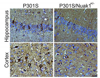 Tau Control Prevents Alzheimer's Disease in Animal Models