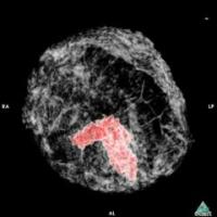 Video of 3-D CT Scan Using EST