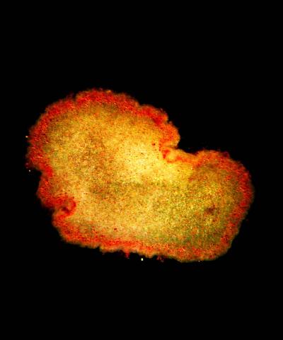 Placozoan