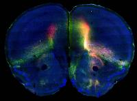 iConnectome Brain Image (2 of 2)