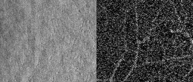 AO Reveals Smallest Blood Vessels in the Eye