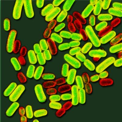 Genetically Identical Salmonella in 2 Forms