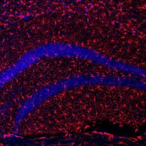 Klotho: a protein that promotes healthy aging and improves longevity