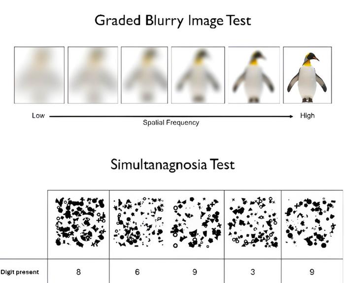 Two new visual tests have been developed to detect early signs of dementia in Lewy body disease.
