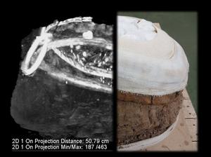 Cauldron and CT Scan Montage