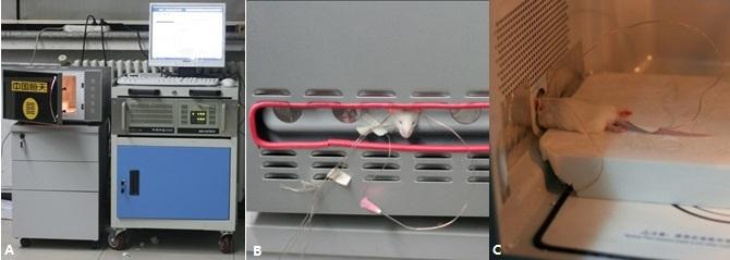 Hyperthermia Device