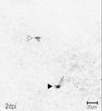 Stem Cells Evolving into Nerve Cells