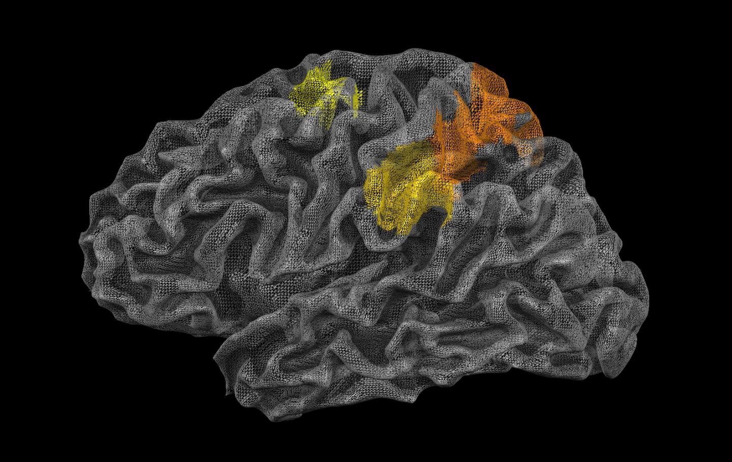Brain Physics Wire Frame