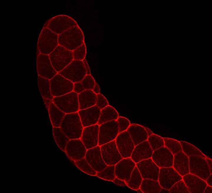 Fluorescence Microscopy