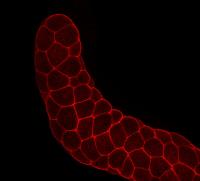 Fluorescence Microscopy