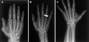 First diagnostic X-rays in space mark new era for astronaut health