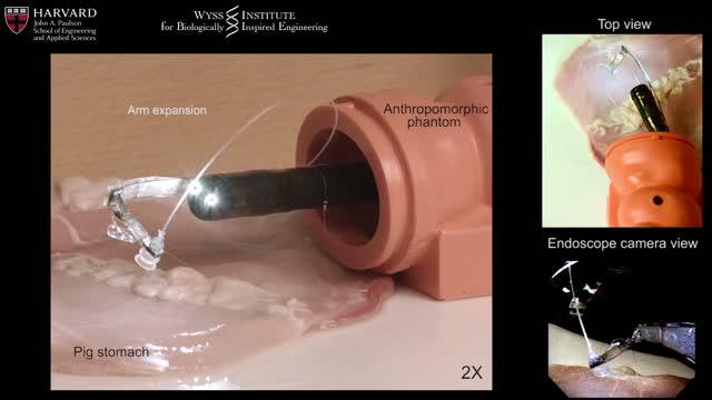 Tissue Counter-Traction
