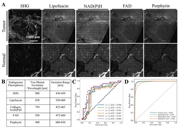 High-accuracy tumor detection with label-free microscopy and neural networks : part of the process.