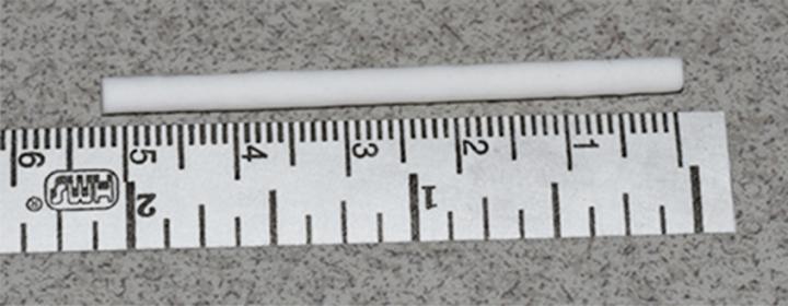 Synthetic Nerve Conduit Bridges the Gap in Arm Nerve Repair (1 of 10)