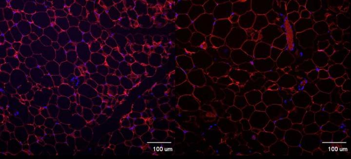 UBC Scientists Discover Possible 'Obesity Gene'